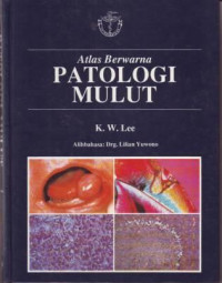 Atlas Berwarna Patologi Mulut